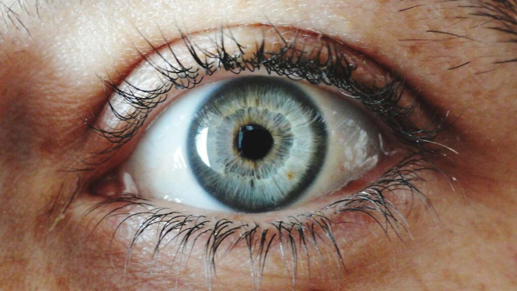 Cannabis reduces intraocular pressure