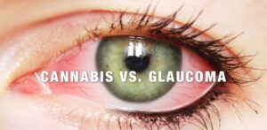 Star Killer glaucoma