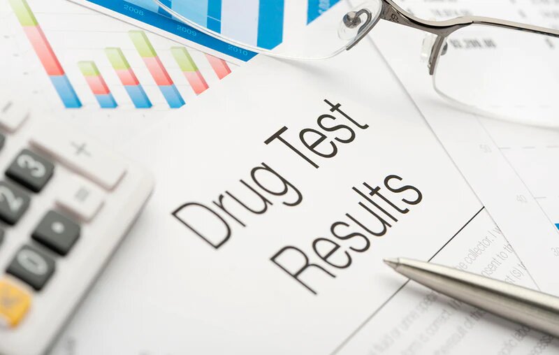 Will CBD Appear on a Drug Test