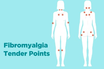 rip city purps fibromyalgia